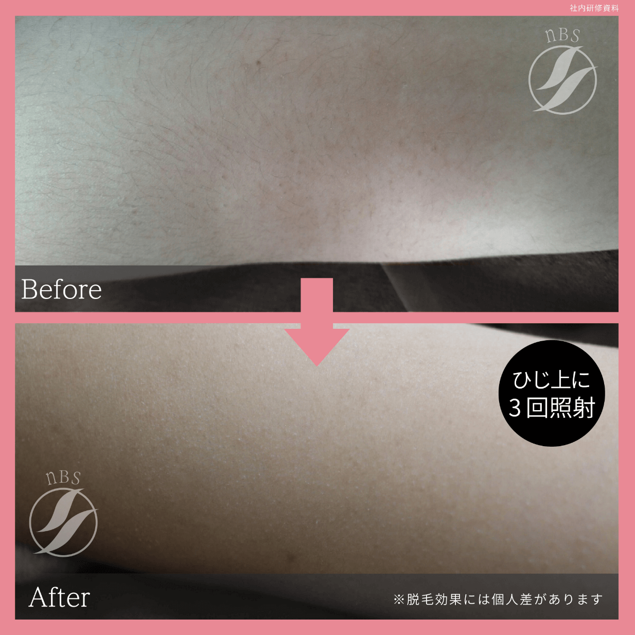 光フェイシャル メニュー